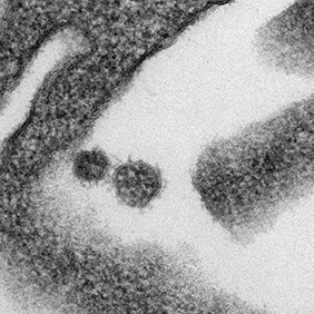 Les équipes d’Ali Amara, virologue, et Vassili Soumelis, immunologiste publient une étude